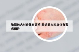 胎记长大对身体有害吗 胎记长大对身体有害吗图片