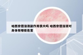 哈西奈德溶液副作用很大吗 哈西奈德溶液对身体有哪些危害