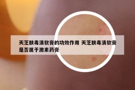 天芝肤毒清软膏的功效作用 天芝肤毒清软膏是否属于激素药膏