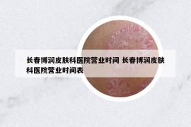 长春博润皮肤科医院营业时间 长春博润皮肤科医院营业时间表