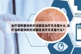 治疗湿疹最快的方法最佳治疗方法是什么 治疗湿疹最快的方法最佳治疗方法是什么?