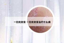 一扫光软膏 一扫光软膏治疗什么病