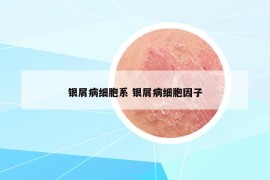 银屑病细胞系 银屑病细胞因子