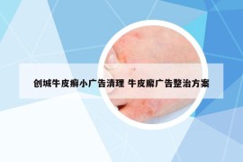 创城牛皮癣小广告清理 牛皮廨广告整治方案