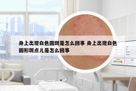 身上出现白色圆斑是怎么回事 身上出现白色圆形斑点儿是怎么回事