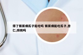 得了银屑病瓜子能吃吗 银屑病能吃瓜子,杏仁,核桃吗