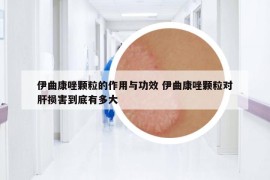 伊曲康唑颗粒的作用与功效 伊曲康唑颗粒对肝损害到底有多大