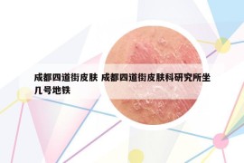 成都四道街皮肤 成都四道街皮肤科研究所坐几号地铁