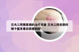 兰大二院银屑病的治疗设备 兰大二院皮肤科哪个医生看白斑看的好