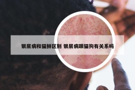 银屑病和猫鲜区别 银屑病跟猫狗有关系吗