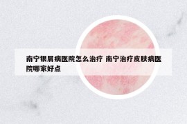 南宁银屑病医院怎么治疗 南宁治疗皮肤病医院哪家好点
