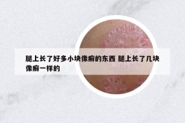 腿上长了好多小块像癣的东西 腿上长了几块像癣一样的