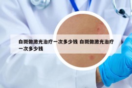 白斑做激光治疗一次多少钱 白斑做激光治疗一次多少钱