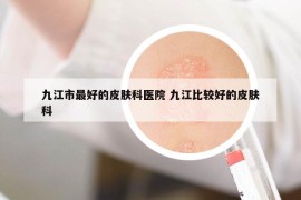 九江市最好的皮肤科医院 九江比较好的皮肤科