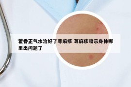 藿香正气水治好了荨麻疹 荨麻疹暗示身体哪里出问题了