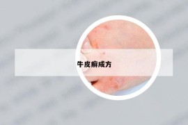 牛皮癣成方
