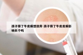 孩子得了牛皮癣想放弃 孩子得了牛皮皮癣影响长个吗