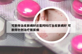 可散停治皮肤病好还是阿科打治皮肤病好 可散停针剂治疗银屑病
