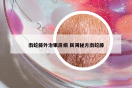 南蛇藤外治银屑病 民间秘方南蛇藤