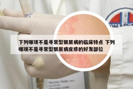 下列哪项不是寻常型银屑病的临床特点 下列哪项不是寻常型银屑病皮疹的好发部位