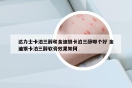 达力士卡泊三醇和金迪银卡泊三醇哪个好 金迪银卡泊三醇软膏效果如何