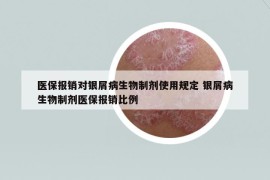 医保报销对银屑病生物制剂使用规定 银屑病生物制剂医保报销比例