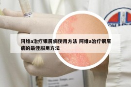 阿维a治疗银屑病使用方法 阿维a治疗银屑病的最佳服用方法