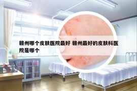 赣州哪个皮肤医院最好 赣州最好的皮肤科医院是哪个