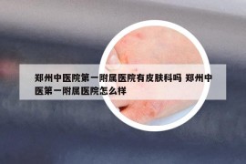 郑州中医院第一附属医院有皮肤科吗 郑州中医第一附属医院怎么样