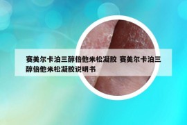 赛美尔卡泊三醇倍他米松凝胶 赛美尔卡泊三醇倍他米松凝胶说明书