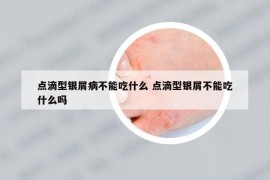 点滴型银屑病不能吃什么 点滴型银屑不能吃什么吗