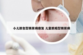 小儿脓包型银屑病康复 儿童脓疱型银屑病