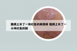 胳膊上长了一块红色的癣很痒 胳膊上长了一小块红色的藓