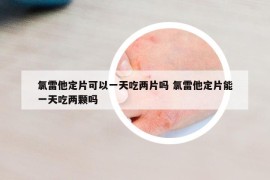 氯雷他定片可以一天吃两片吗 氯雷他定片能一天吃两颗吗