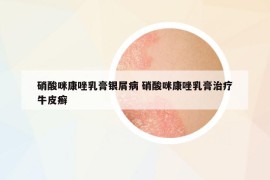 硝酸咪康唑乳膏银屑病 硝酸咪康唑乳膏治疗牛皮癣