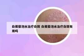 白蒺藜泡水治疗白斑 白蒺藜泡水治疗白斑有用吗