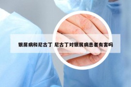 银屑病和尼古丁 尼古丁对银屑病患者有害吗