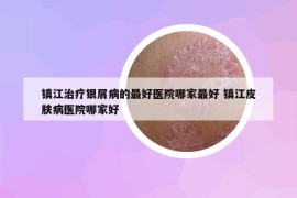 镇江治疗银屑病的最好医院哪家最好 镇江皮肤病医院哪家好