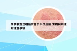 生物制剂注射后有什么不良反应 生物制剂注射注意事项