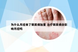 为什么月经来了银屑病加重 治疗银屑病会影响月经吗