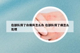 在部队得了白癜风怎么办 在部队得了病怎么处理