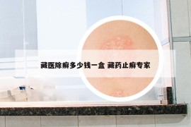藏医除癣多少钱一盒 藏药止癣专家