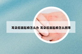 耳朵后面起癣怎么办 耳朵后面起癣怎么回事