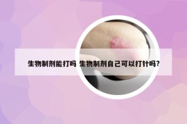 生物制剂能打吗 生物制剂自己可以打针吗?