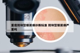 重度斑块型银屑病诊断标准 斑块型银屑病严重吗
