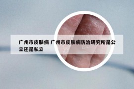 广州市皮肤病 广州市皮肤病防治研究所是公立还是私立
