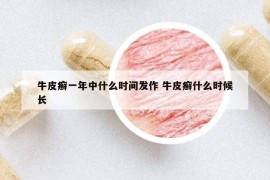 牛皮癣一年中什么时间发作 牛皮癣什么时候长