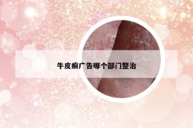 牛皮癣广告哪个部门整治