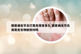 银屑病关节炎打类克得用多久 银屑病关节炎用类克生物制剂对吗