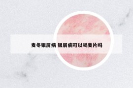 麦冬银屑病 银屑病可以喝麦片吗